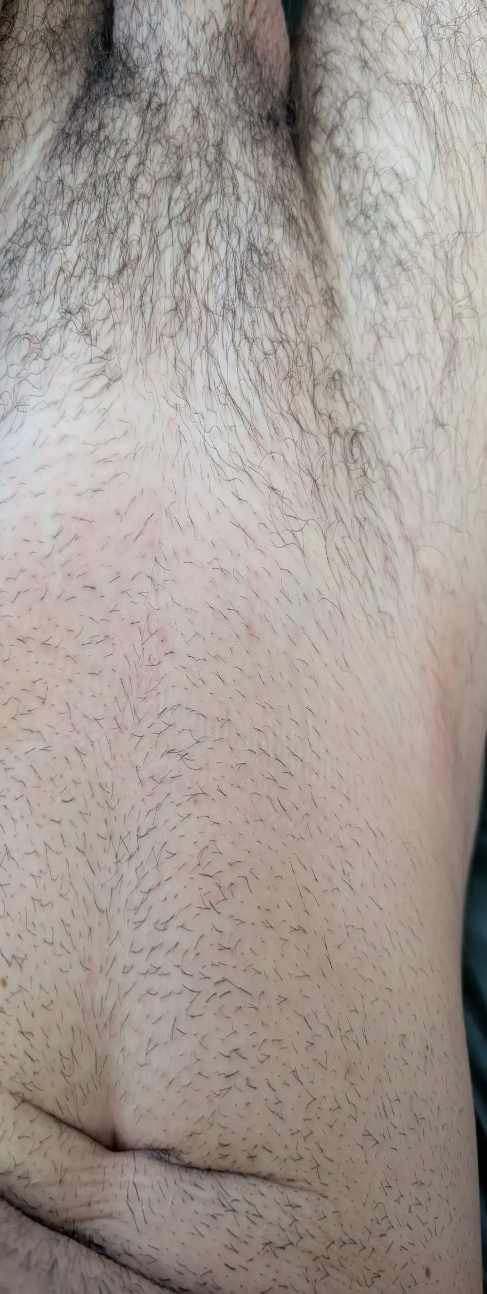 A_DV78